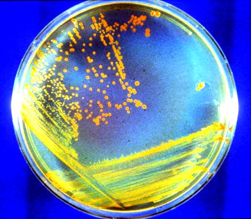 D. rad Bacteria